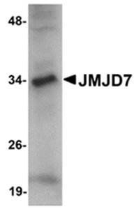 JMJD7 Antibody