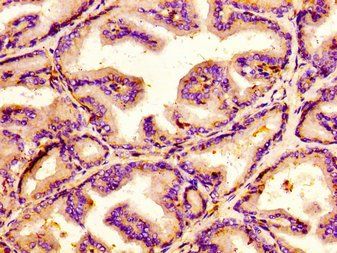 JMY Antibody