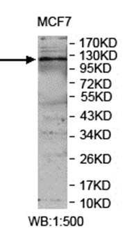JMY Rabbit Polyclonal Antibody