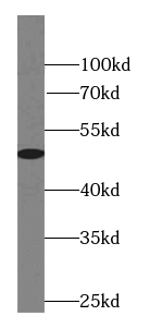 JNK antibody