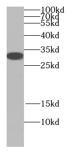 JP45 antibody
