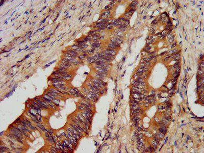 JPH1 Antibody