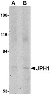 JPH1 Antibody