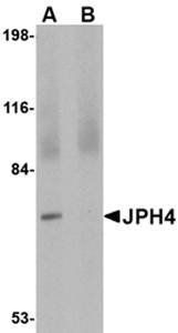 JPH4 Antibody