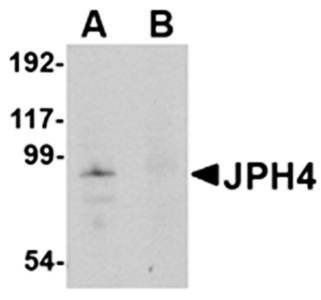 JPH4 Antibody