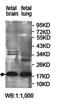 JTB Rabbit Polyclonal Antibody