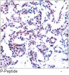 JunB (Phospho-Ser259) Antibody