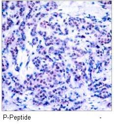 JunD (Phospho-Ser255) Antibody