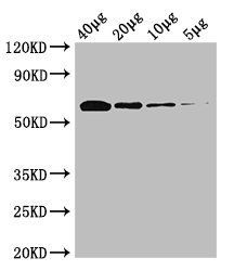 k12 Pyruvate dehydrogenase antibody (Biotin)