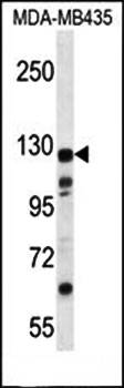 K1324 antibody