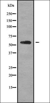 K2C6B antibody
