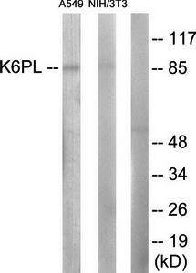 K6PL antibody