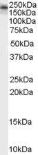 KALRN antibody