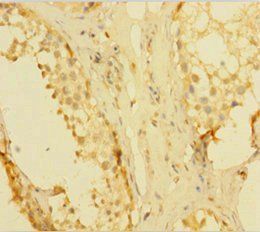 Kallikrein-1 antibody