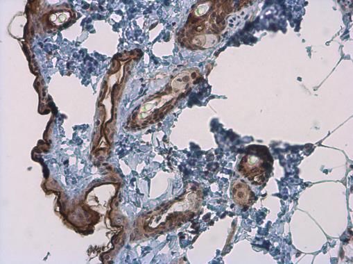 Kallikrein 7 Rabbit Polyclonal Antibody
