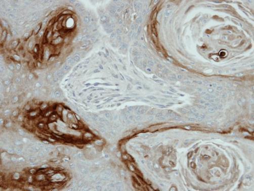 Kallikrein 7 Rabbit Polyclonal Antibody
