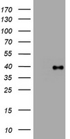 Kallikrein 7 (KLK7) antibody