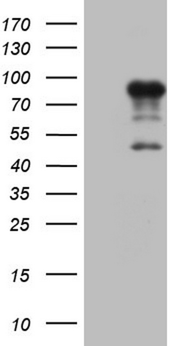 Kallikrein 8 (KLK8) antibody