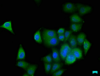 KALRN antibody