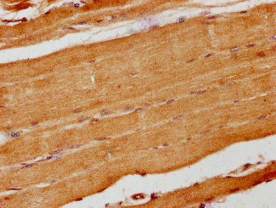 KANK1 Antibody