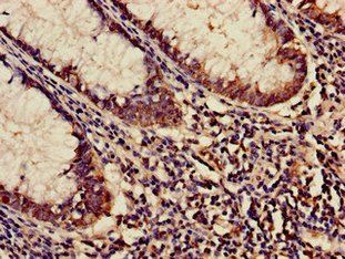 KARS Antibody