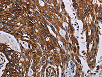 KARS Antibody
