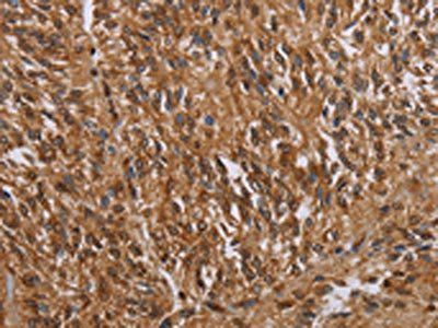 KARS Antibody