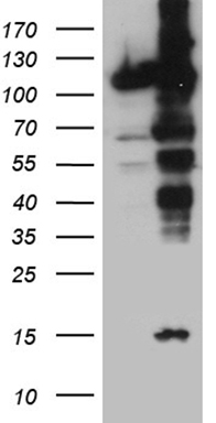 Karyopherin beta 3 (IPO5) antibody