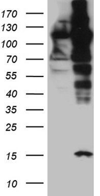 Karyopherin beta 3 (IPO5) antibody