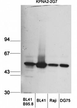 Karyopherin alpha2 antibody