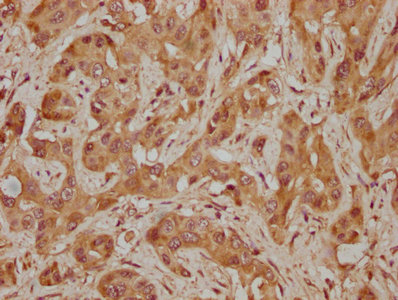 KAT2A Antibody