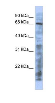 KAT5 antibody