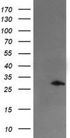 katanin p80 Antibody