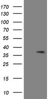 katanin p80 Antibody