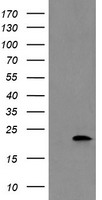 katanin p80 Antibody