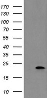 katanin p80 (KATNB1) antibody