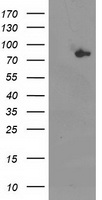 KATNAL1 Antibody