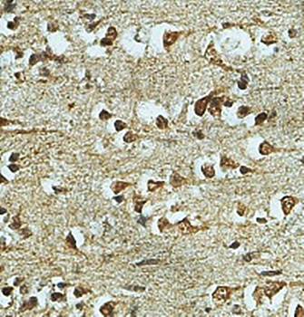 KATNAL1 Rabbit Polyclonal Antibody