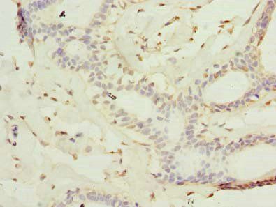 KATNAL2 Antibody