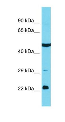 KBTBD12 antibody