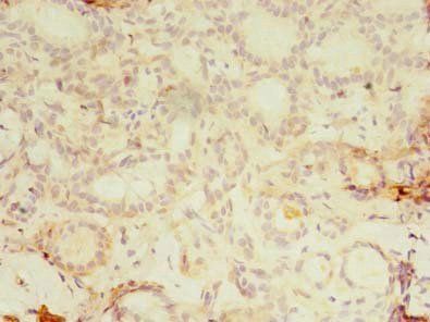 KBTBD4 Antibody