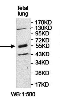 KBTBD4 Rabbit Polyclonal Antibody