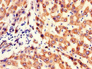 KBTBD6 Antibody