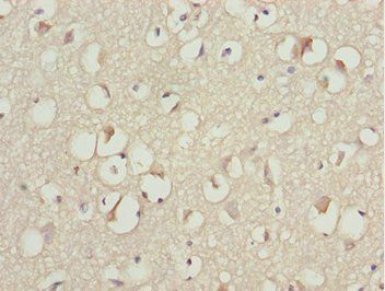 KBTBD7 Antibody