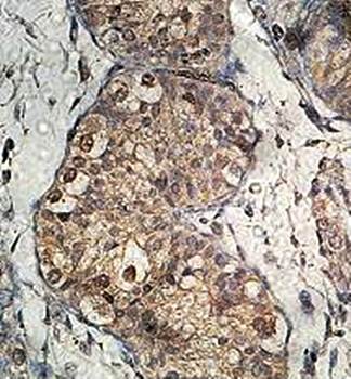 KBTBD7 Rabbit Polyclonal Antibody