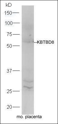 KBTBD8 antibody