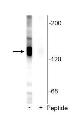 Potassium Chloride Cotransporter (KCC2) (Ser940) Antibody
