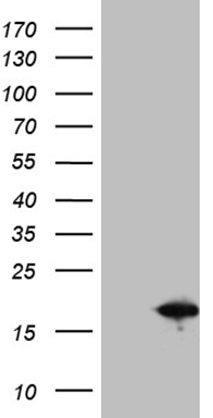 KChIP2 (KCNIP2) antibody