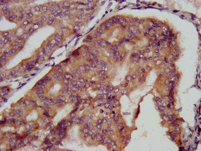 KCMF1 Antibody