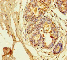 KCNA6 Antibody
